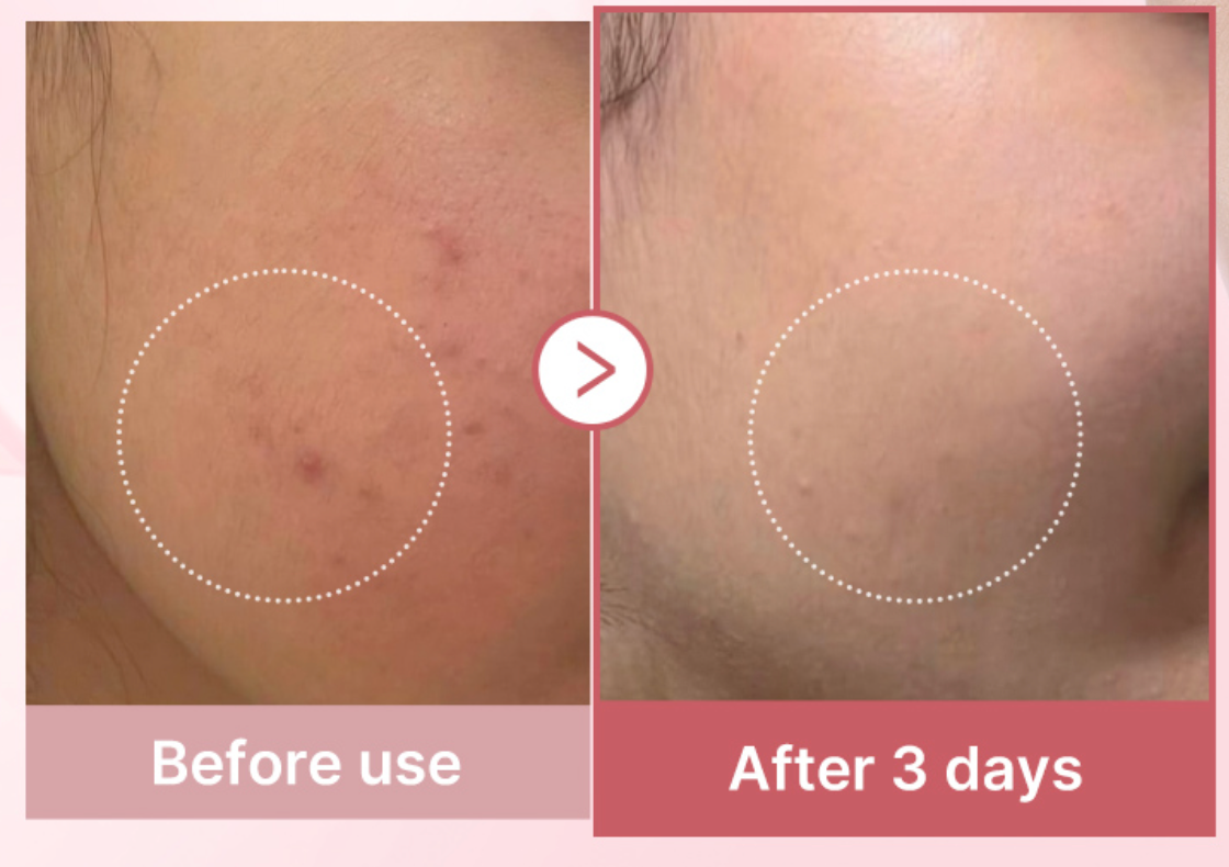 Medicube PDRN Pink Collagen Capsule Cream