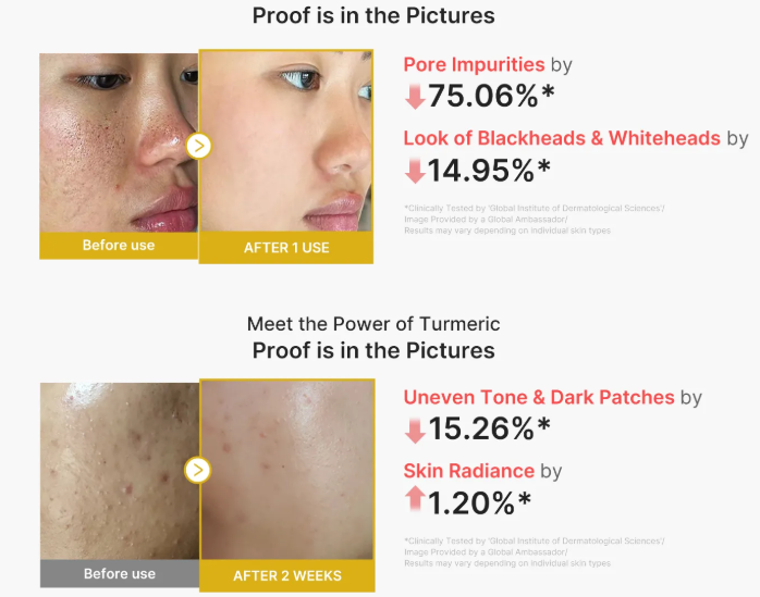 Medicube Kojic Acid Turmeric Peel Shot