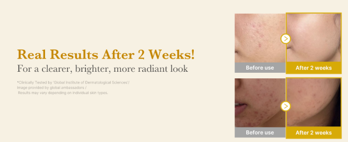 Medicube Kojic Acid Turmeric Serum