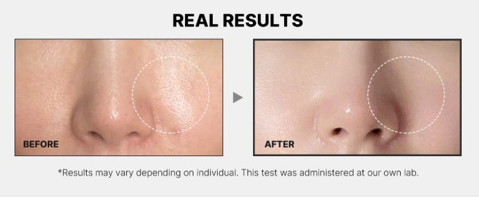 Medicube Zero Pore Pad Mild