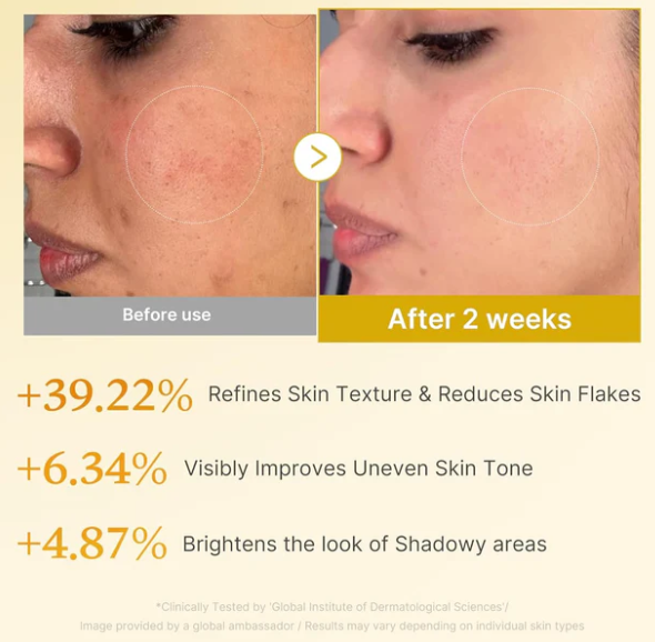Medicube Kojic Acid Turmeric Resurfacing Toner